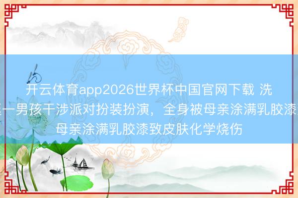 开云体育app2026世界杯中国官网下载 洗不掉了！阿根廷一男孩干涉派对扮装扮演，全身被母亲涂满乳胶漆致皮肤化学烧伤